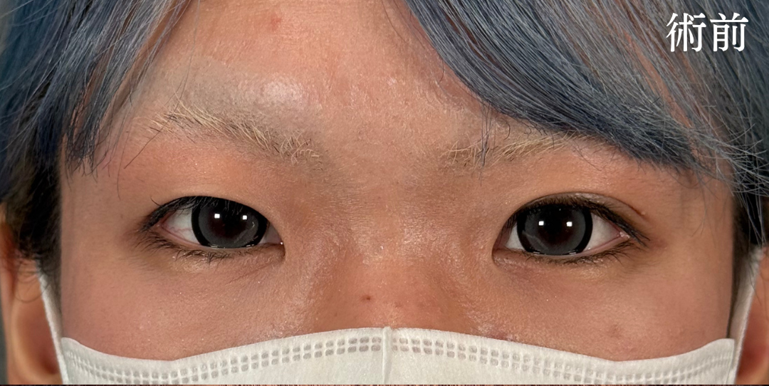 症例のbefore画像