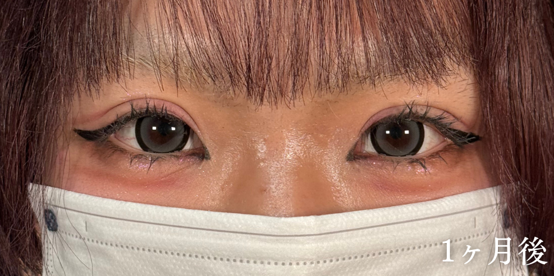 症例のafter画像