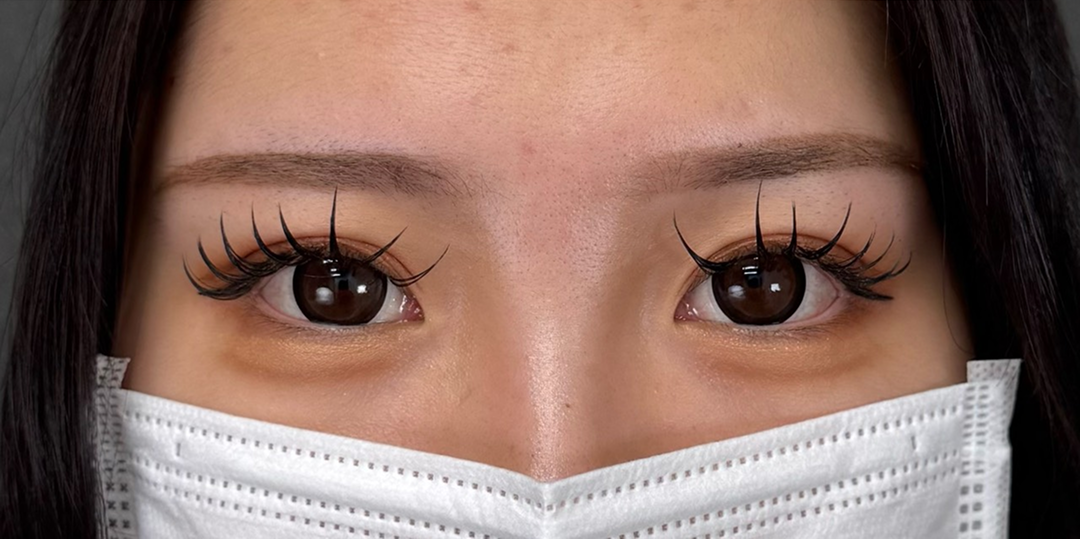 症例のafter画像