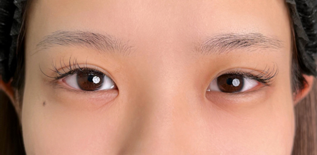 症例のbefore画像