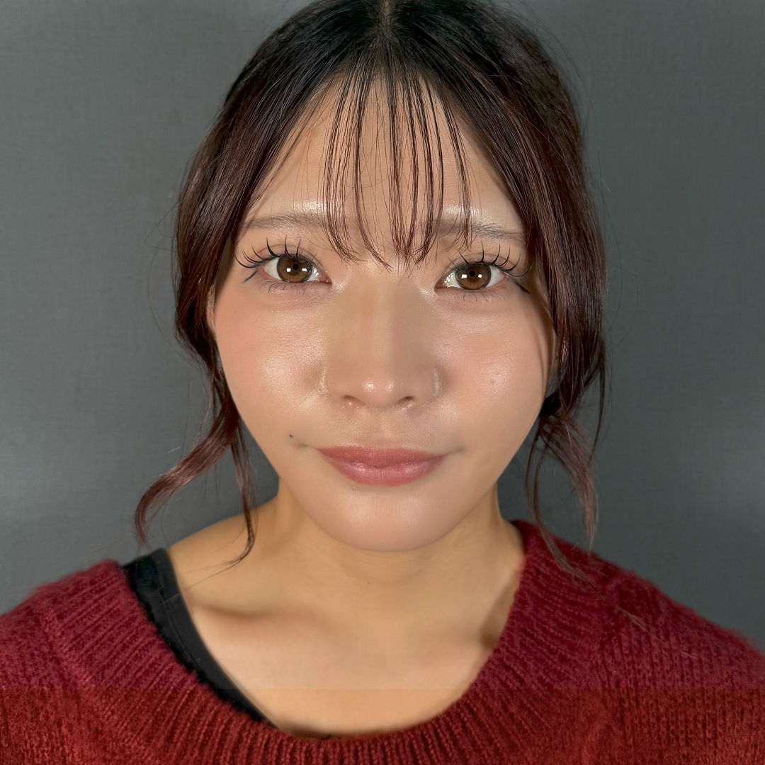 症例のafter画像