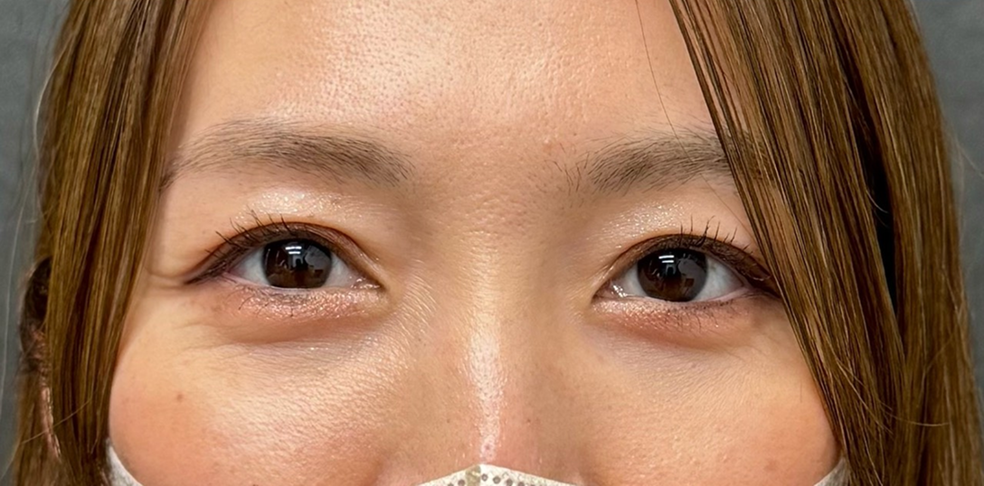 症例のafter画像