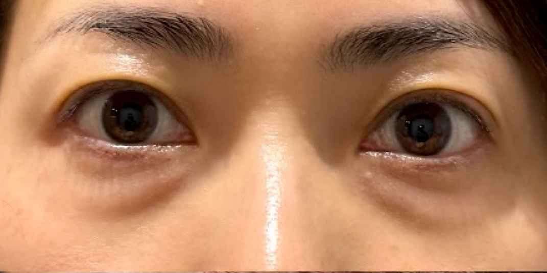 症例のbefore画像