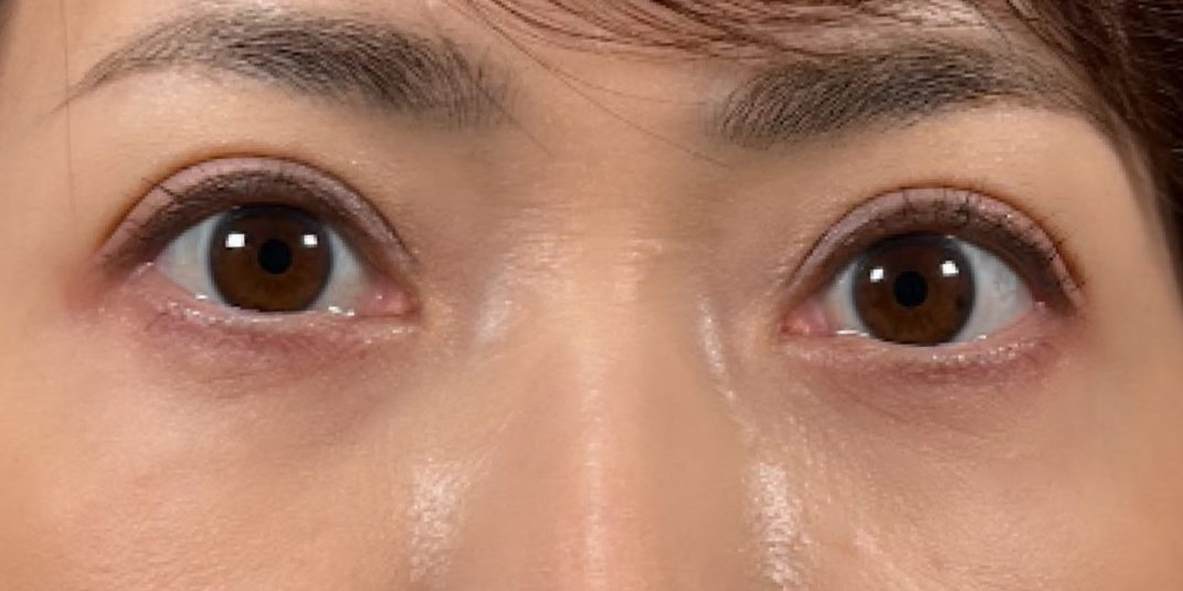 症例のafter画像