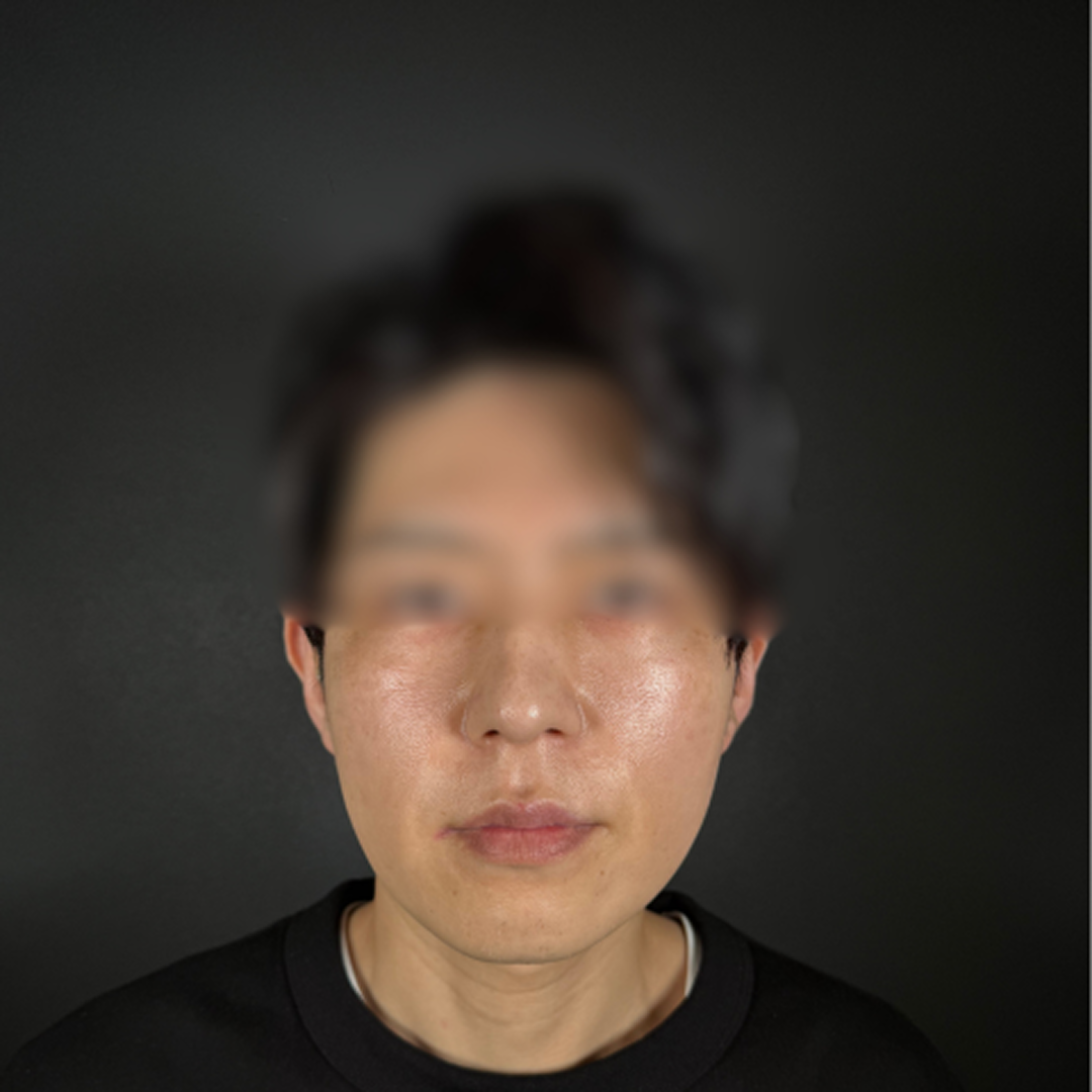 症例のafter画像