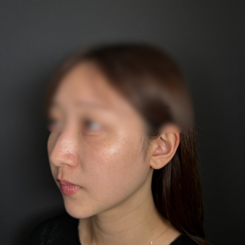 症例のafter画像