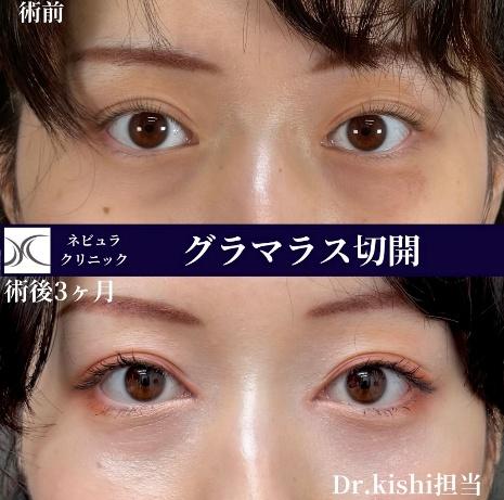 人気のタレ目デザイン