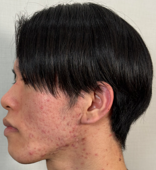 before画像