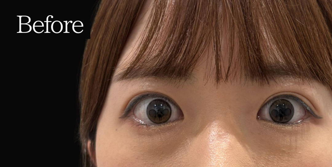 before画像