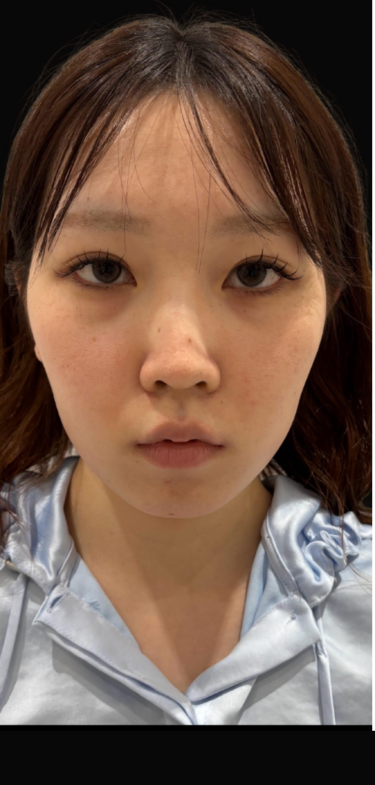 before画像