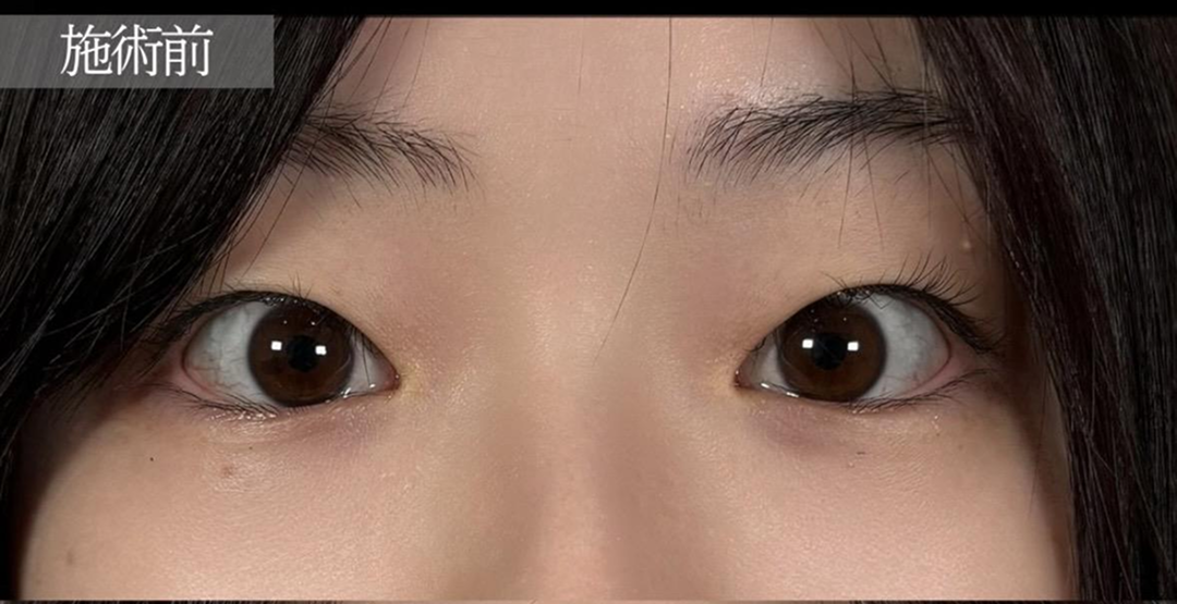 before画像