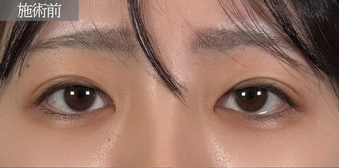 before画像