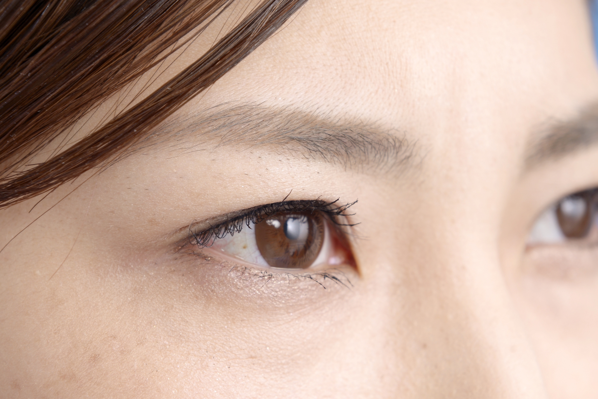 二重埋没の糸がまぶたから出てきた！チクチクする原因と早急な対処法・抜糸について