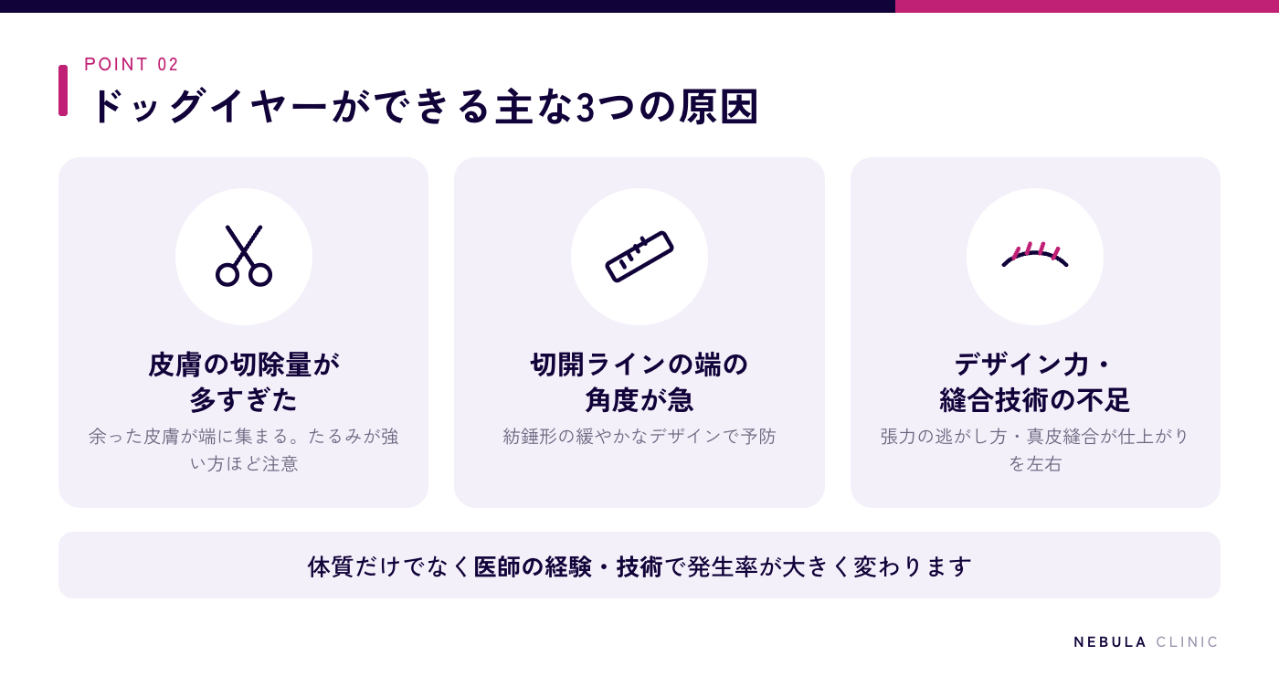 眉下切開でドッグイヤーができる3つの原因（皮膚の切除量が多すぎる・切開ラインの端の角度が急・医師のデザイン力や縫合技術の不足）の図解