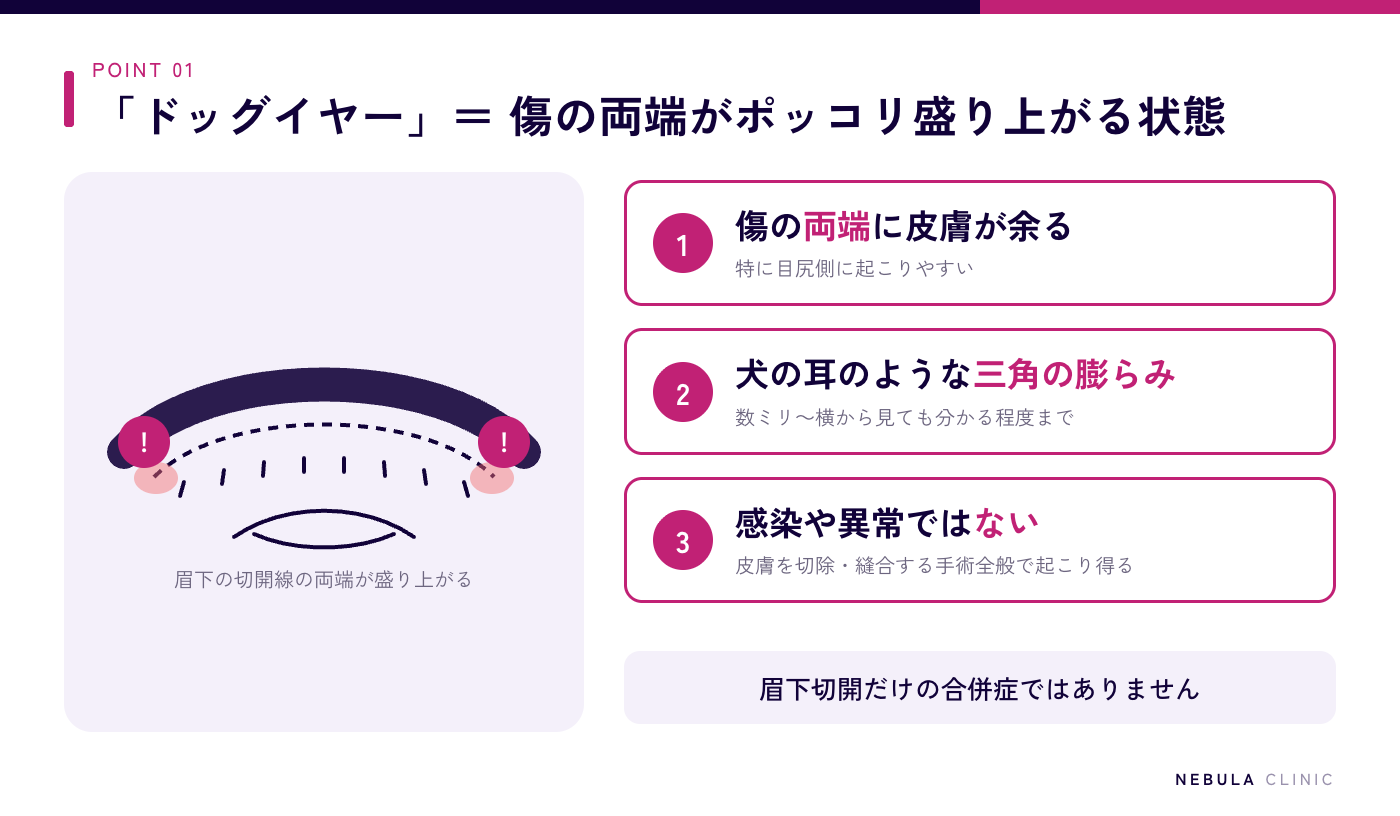 眉下切開のドッグイヤー（縫合した傷の両端の皮膚が余ってポッコリ盛り上がった状態）を示した図解