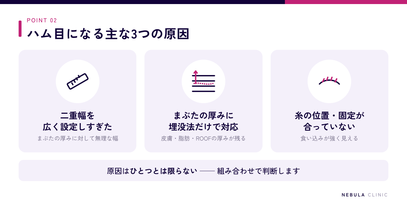 二重埋没法でハム目になる3つの原因(二重幅を広く設定しすぎた・まぶたの脂肪や皮膚の厚みに埋没法だけで対応した・糸の留める位置や固定方法が適切でない)の図解