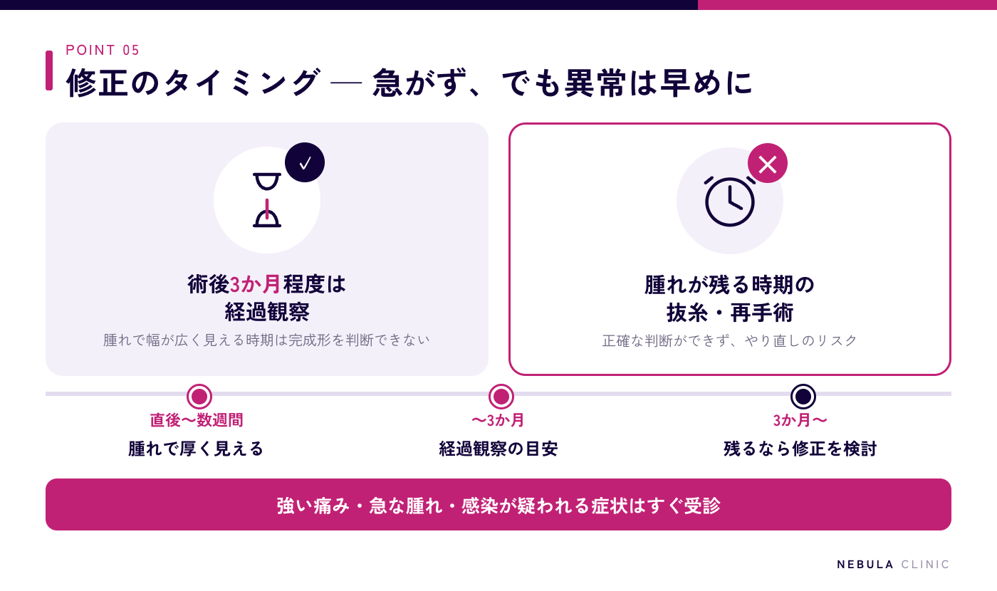 ハム目修正のタイミング(術後3か月程度は経過観察・腫れが残る時期に急いで抜糸するリスク・強い痛みや感染症状があれば早めに受診)を示したタイムライン図解