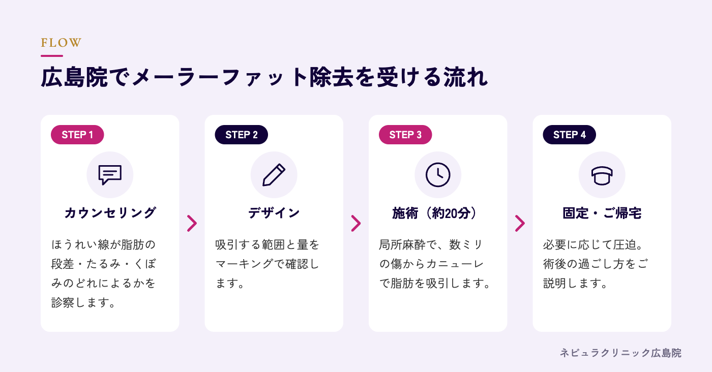 メーラーファット除去を受ける流れの図解
