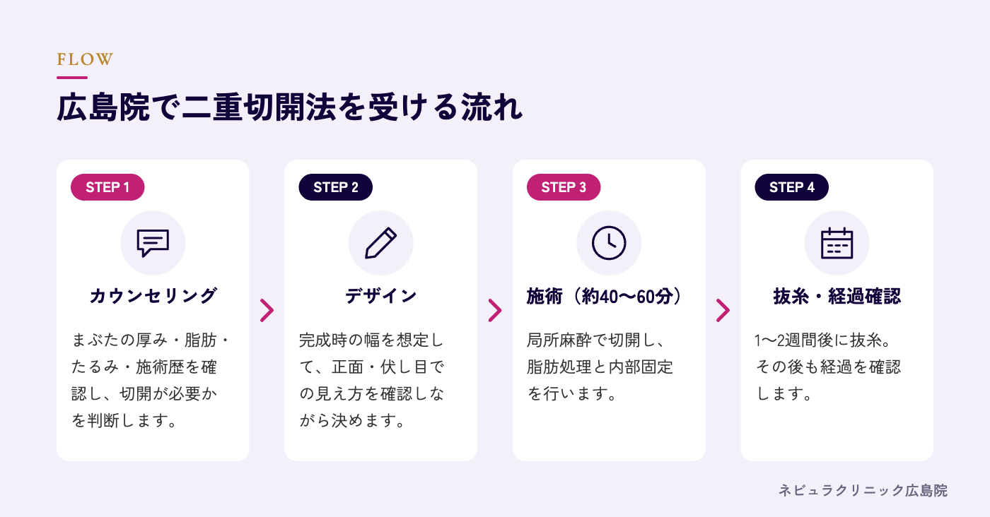 二重切開法を受ける流れの図解