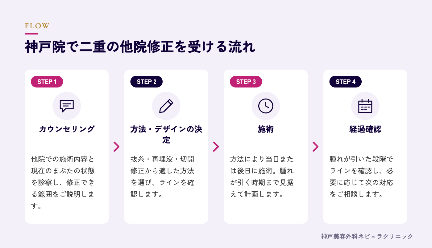 二重の他院修正を受ける流れの図解