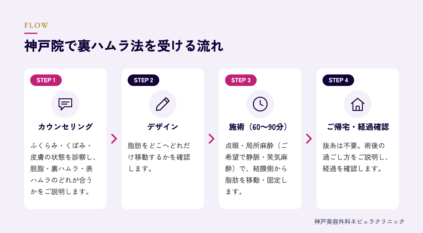 裏ハムラ法を受ける流れの図解