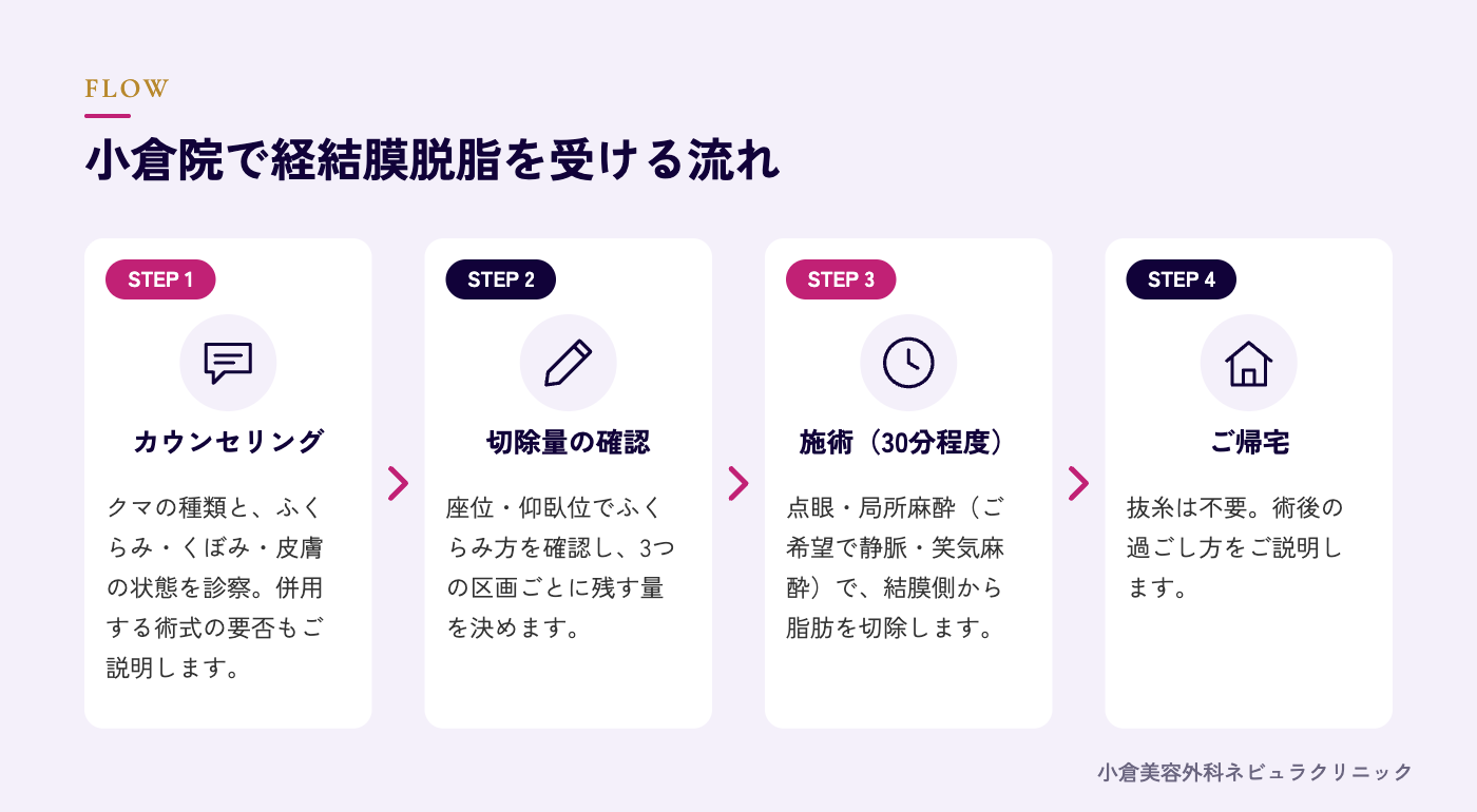 経結膜脱脂を受ける流れの図解