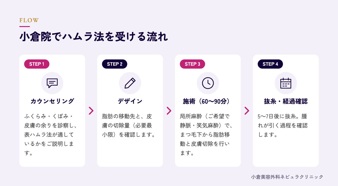 ハムラ法を受ける流れの図解
