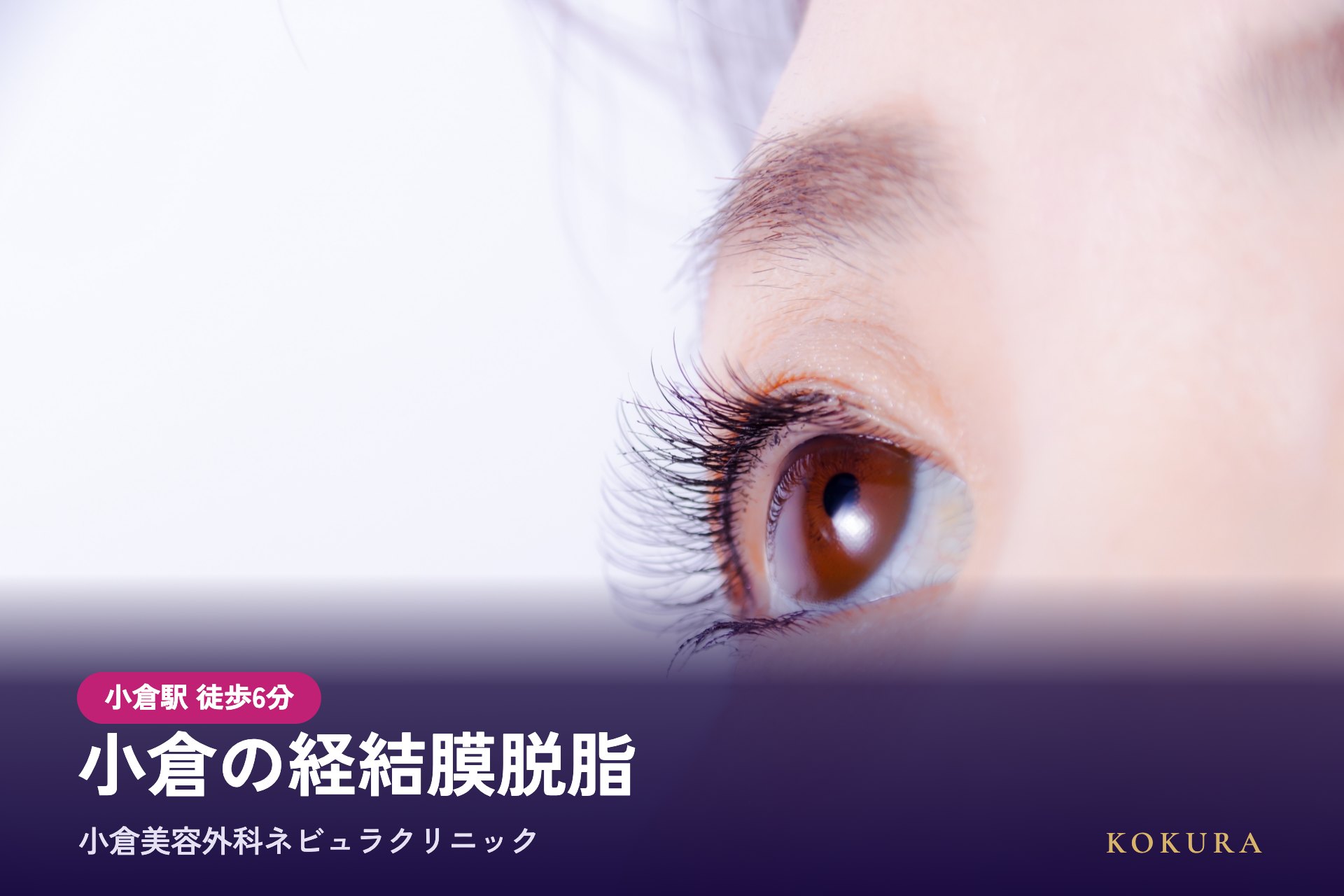 小倉の経結膜脱脂（目の下の脂肪除去）は小倉美容外科ネビュラクリニック