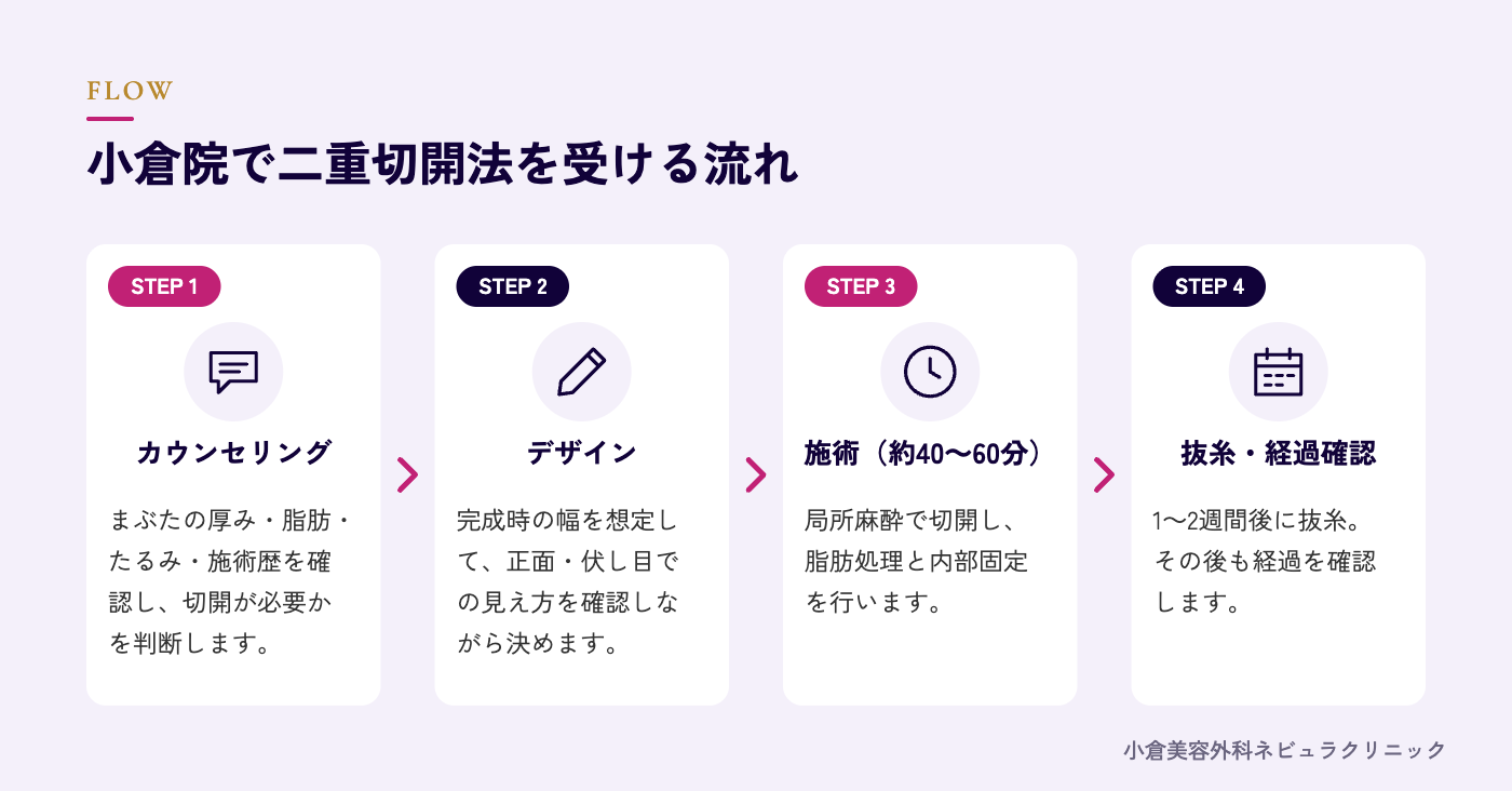 二重切開法を受ける流れの図解