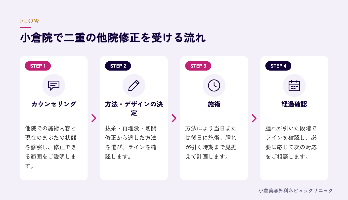 二重の他院修正を受ける流れの図解
