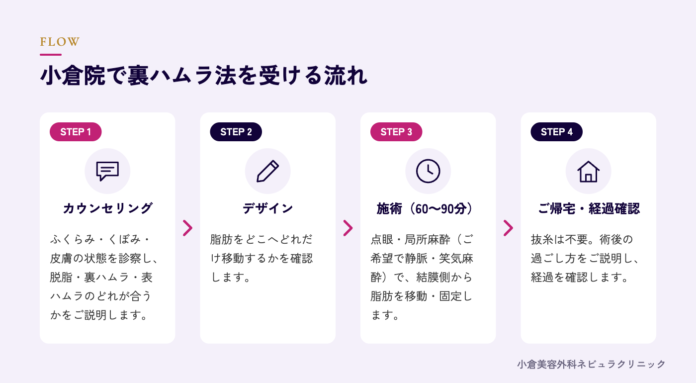 裏ハムラ法を受ける流れの図解