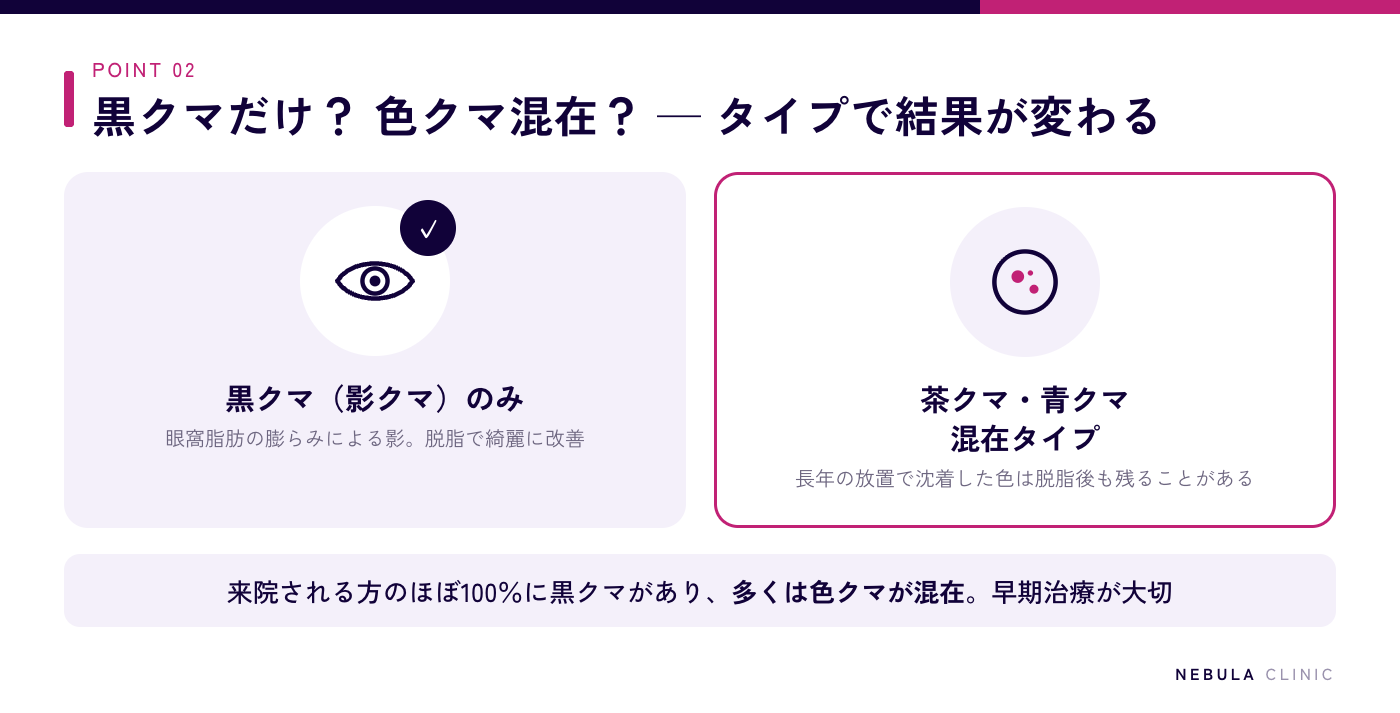 脱脂だけで綺麗になる黒クマ(影クマ)と、脱脂後も色が残る茶クマ・青クマ混在タイプの違いを比較した図解