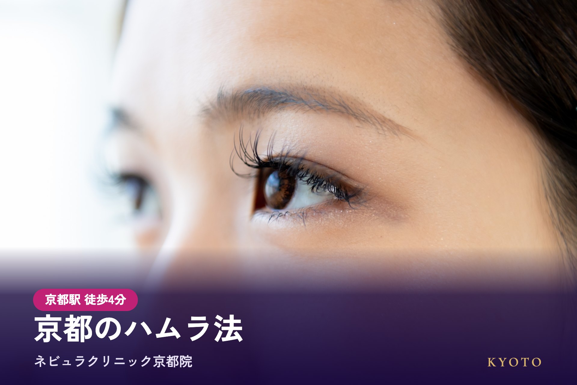 京都のハムラ法（表ハムラ法）はネビュラクリニック京都院