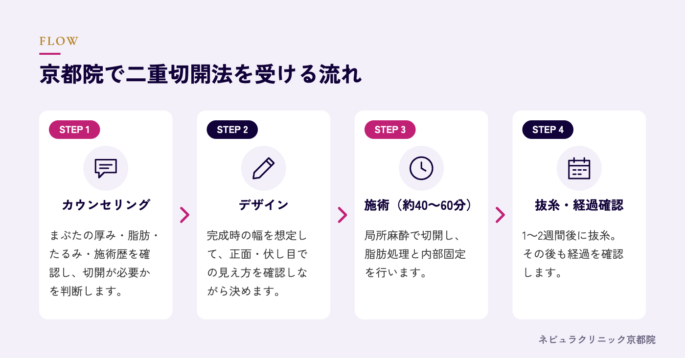 二重切開法を受ける流れの図解