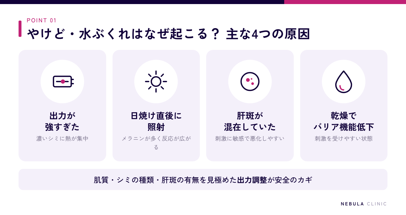 ルメッカ照射後にやけど・水ぶくれが起きる4つの原因（出力が強すぎる・日焼け直後・肝斑の混在・乾燥によるバリア機能低下）の図解
