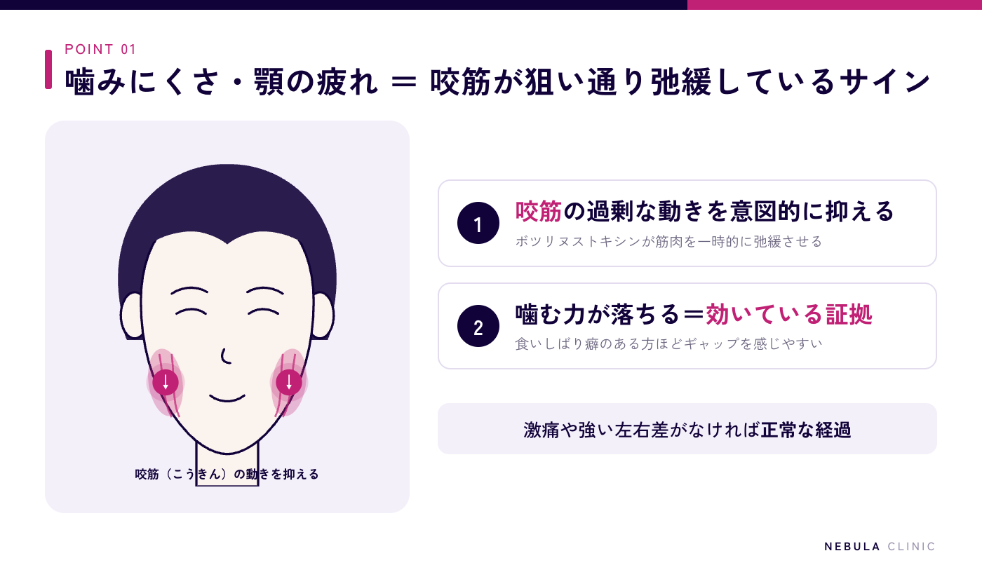 エラボトックス後に噛みにくい・顎が疲れる原因（咬筋の働きを意図的に弱めているため、ボトックスがしっかり効いている証拠の正常な反応）の図解
