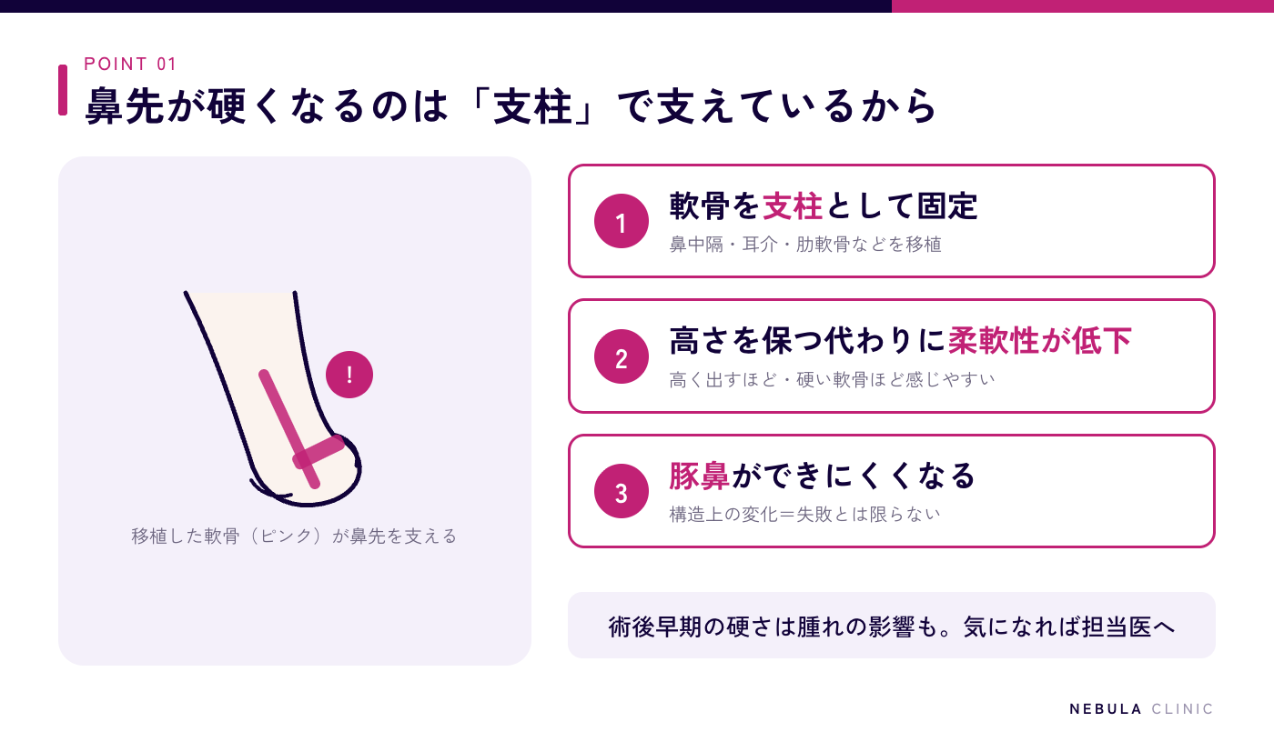 鼻中隔延長後に鼻先が硬くなる理由(軟骨を支柱として固定するため柔軟性が低下し、指で押し上げる豚鼻が難しくなる)を示した図解