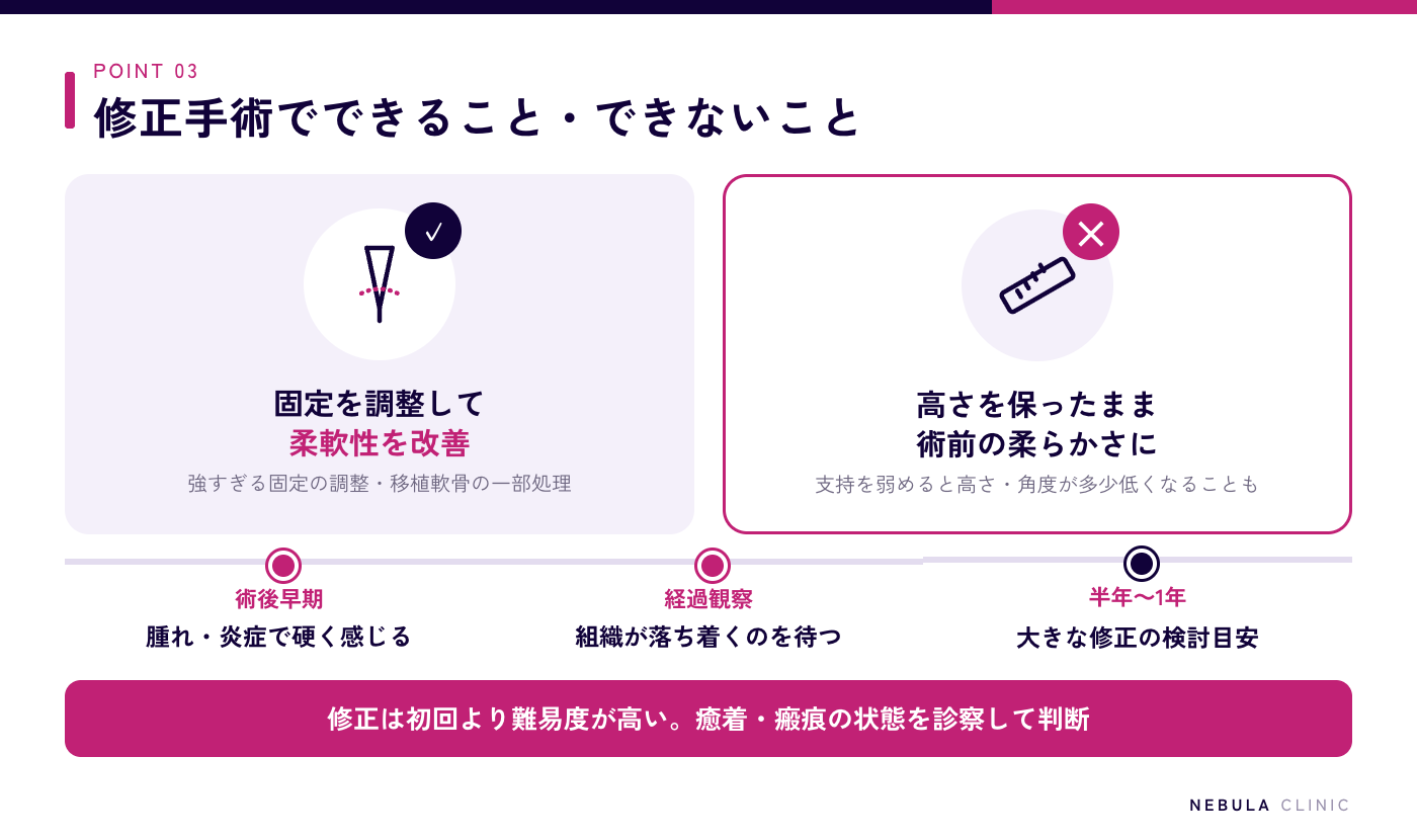 鼻中隔延長の修正手術で可能なこと(固定を調整して柔軟性を持たせる)と注意点(高さや角度が多少低くなる・難易度が高く組織が落ち着いてからの検討が重要)を示した図解
