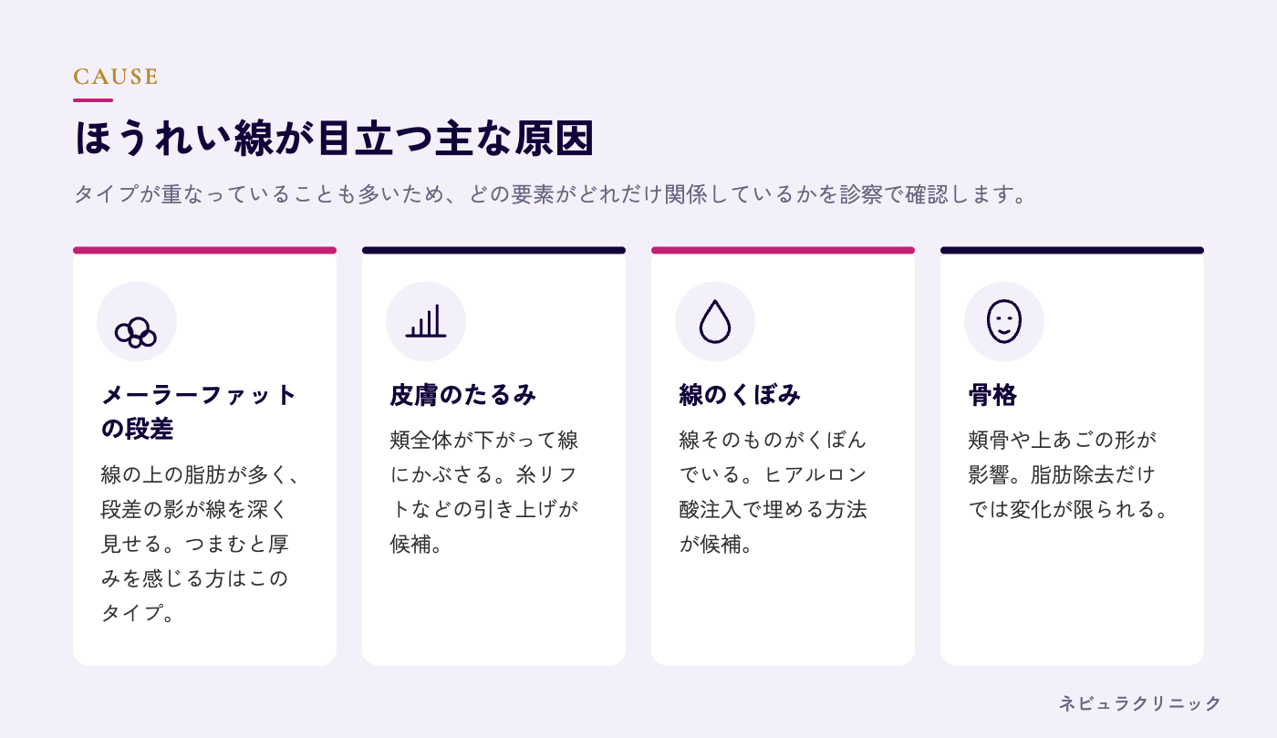 ほうれい線が目立つ原因(メーラーファット・皮膚のたるみ・骨格・くぼみ)の図解