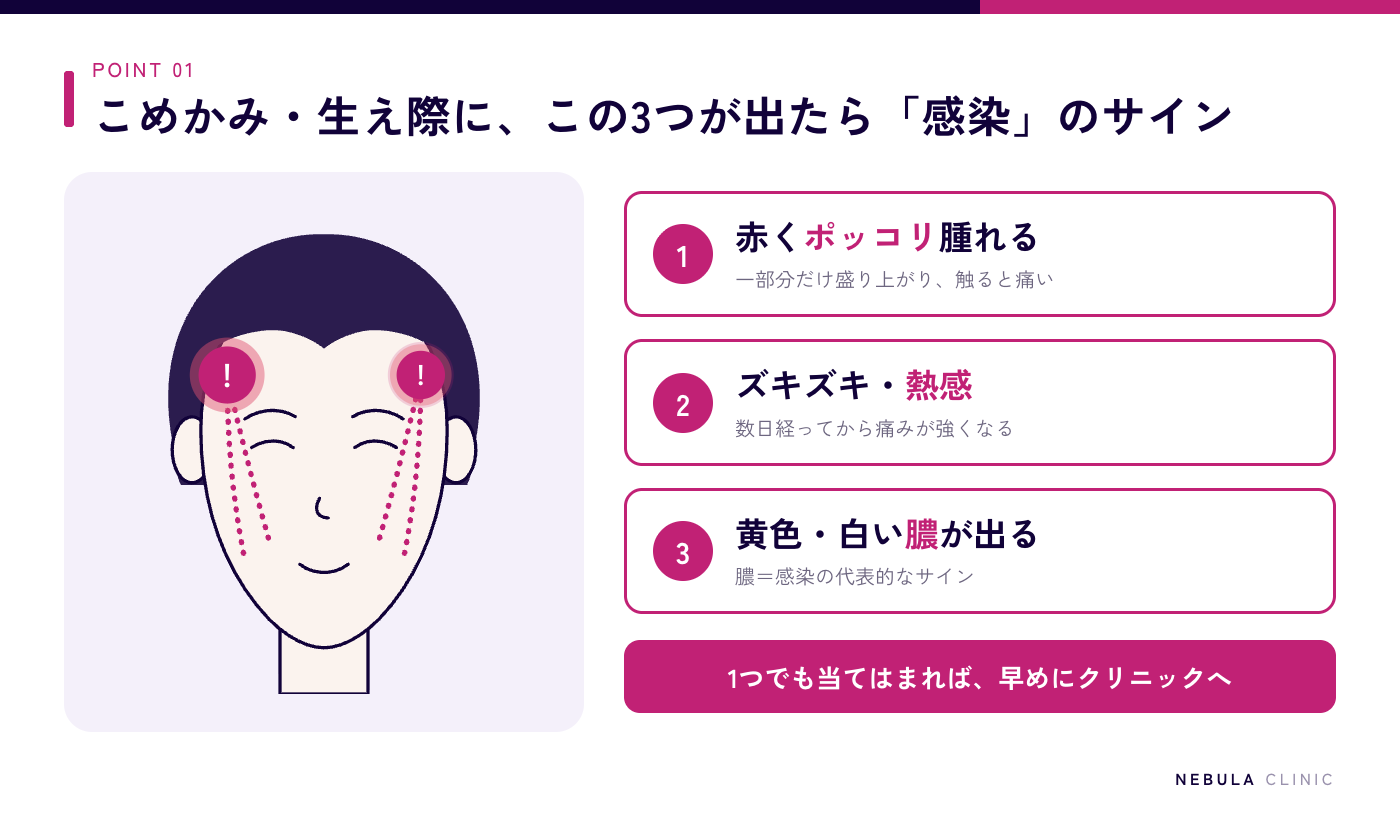 糸リフト後にこめかみ・生え際に出る感染の3つのサイン（赤い腫れ・ズキズキした熱感・膿）の図解