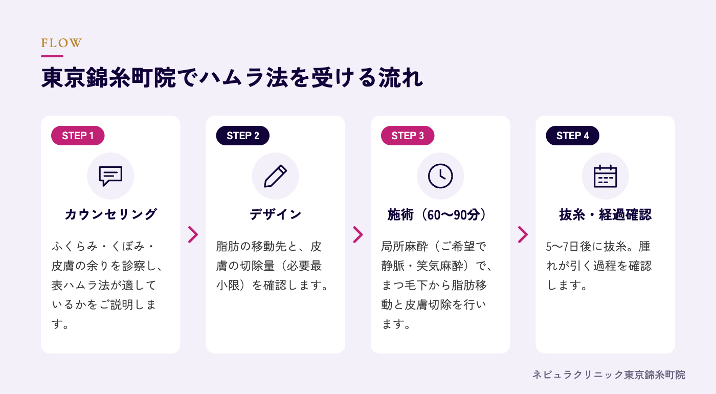 ハムラ法を受ける流れの図解
