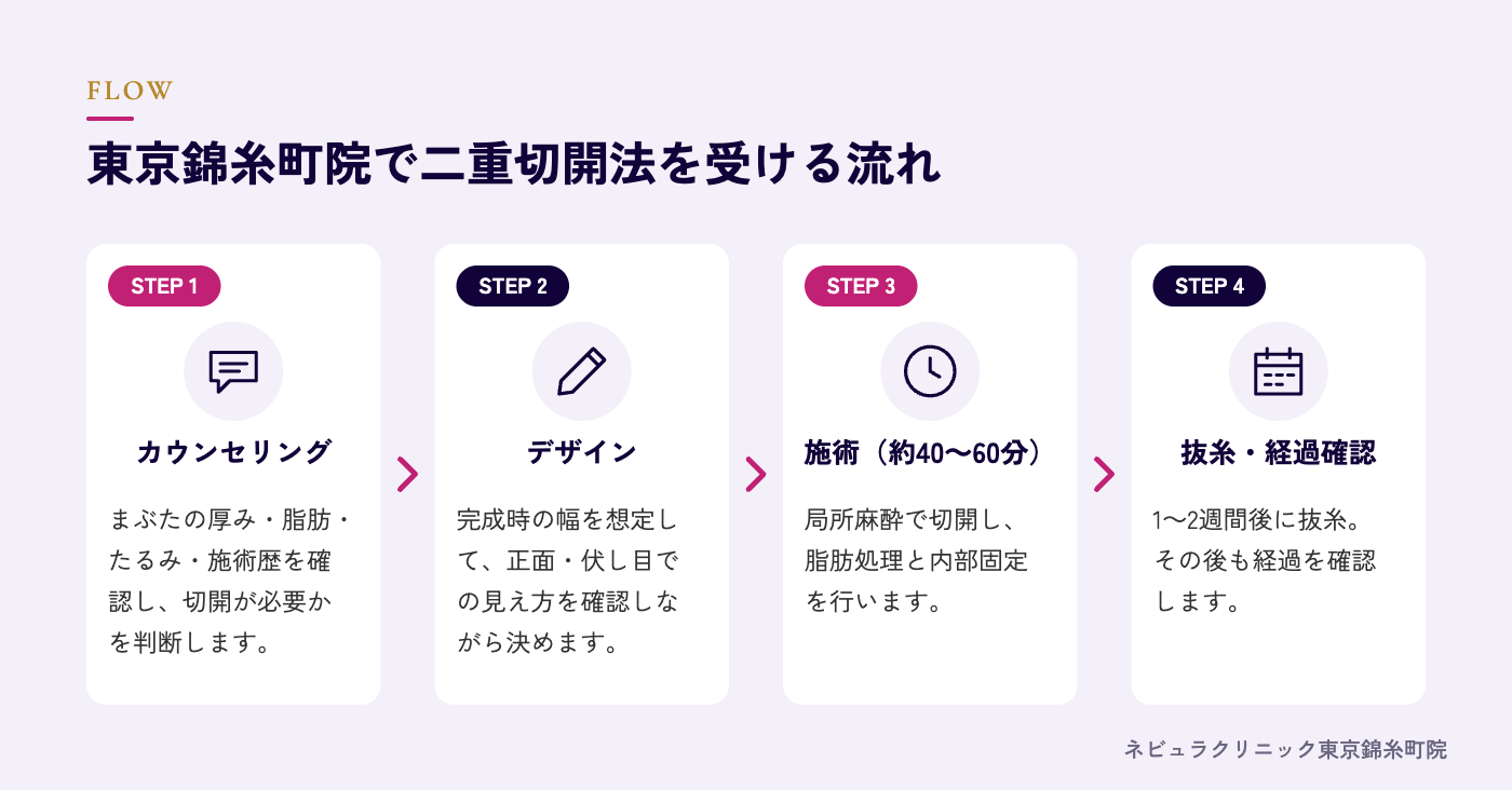 二重切開法を受ける流れの図解