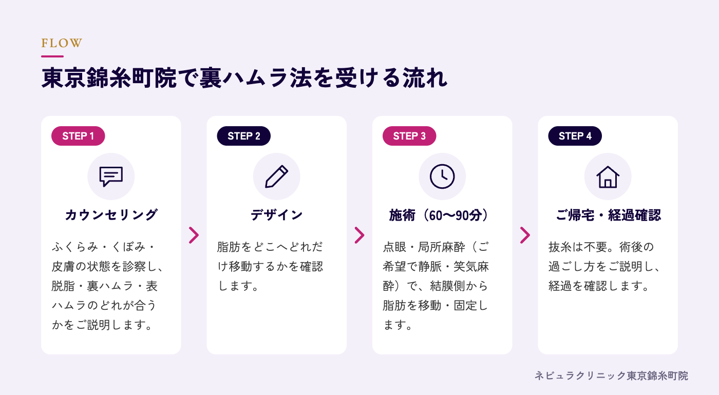 裏ハムラ法を受ける流れの図解