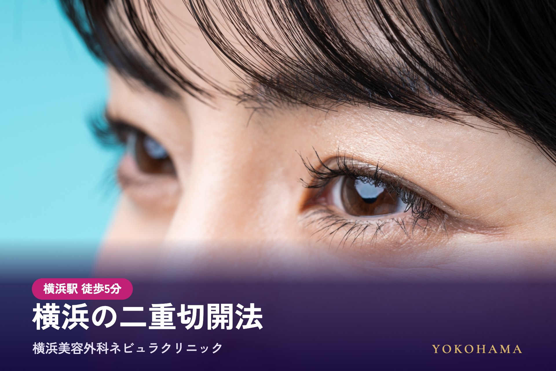 横浜の二重切開法（全切開）は横浜美容外科ネビュラクリニック
