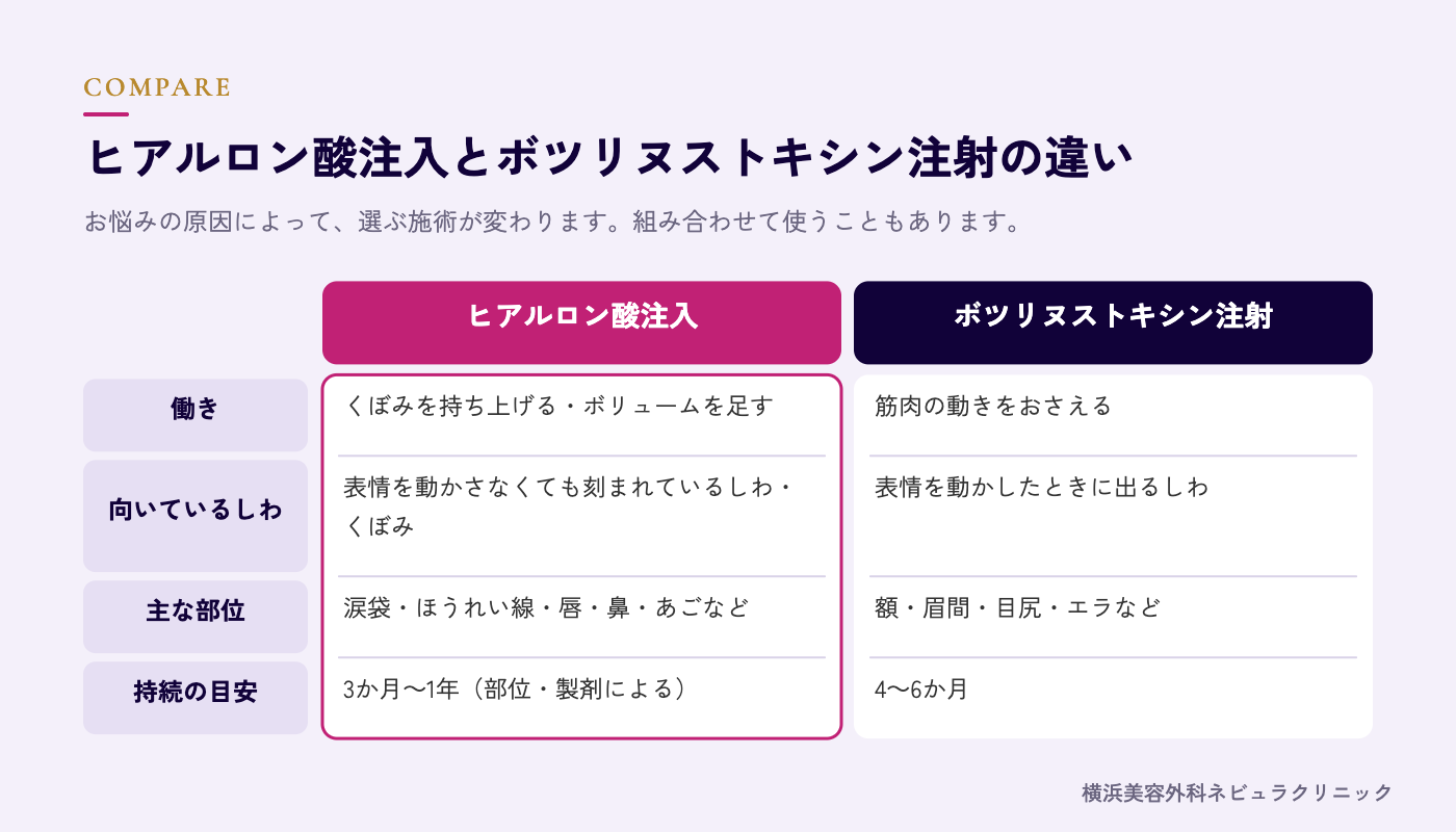 ヒアルロン酸注入とボツリヌストキシン注射の違いの図解