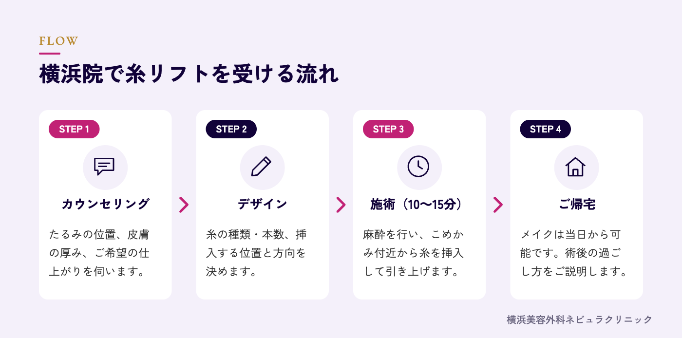横浜院で糸リフトを受ける流れの図解