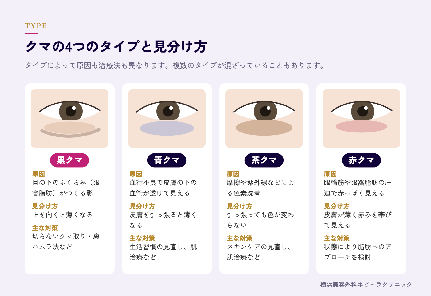 4種類のクマ(黒クマ・青クマ・茶クマ・赤クマ)の見分け方の図解