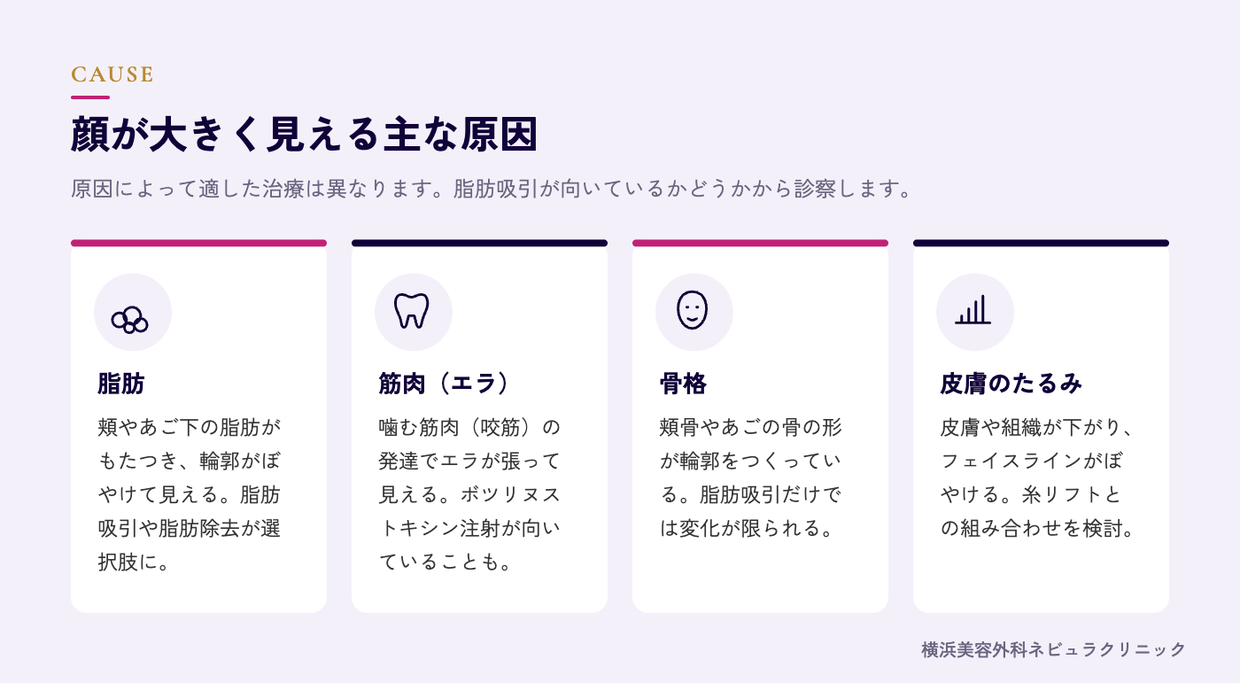 顔が大きく見える原因(脂肪・骨格・筋肉・たるみ)の図解