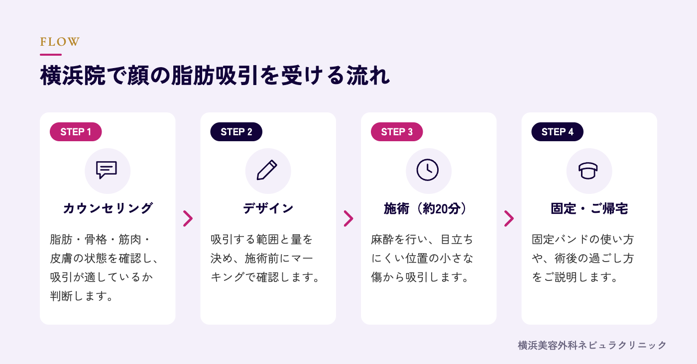 横浜院で顔の脂肪吸引を受ける流れの図解