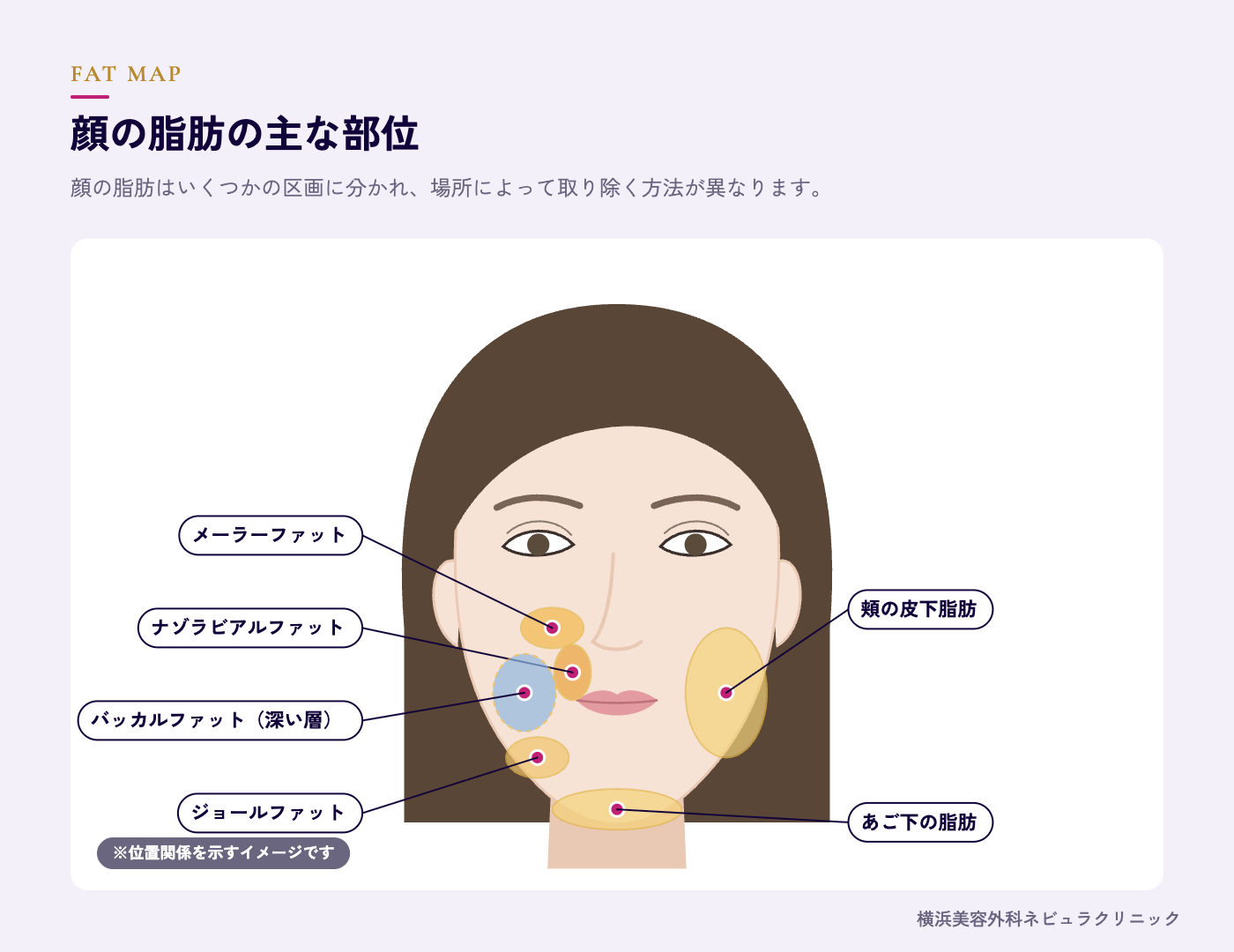 顔の脂肪の部位(頬・あご下・メーラーファット・ジョールファット・バッカルファット)の図解